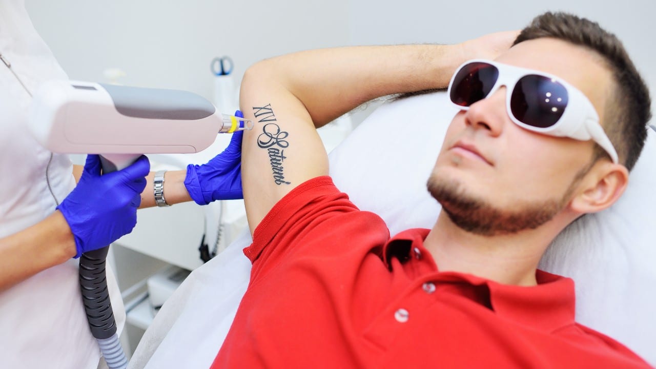 ¿Cómo deshacerte de un tatuaje que ya no te gusta?