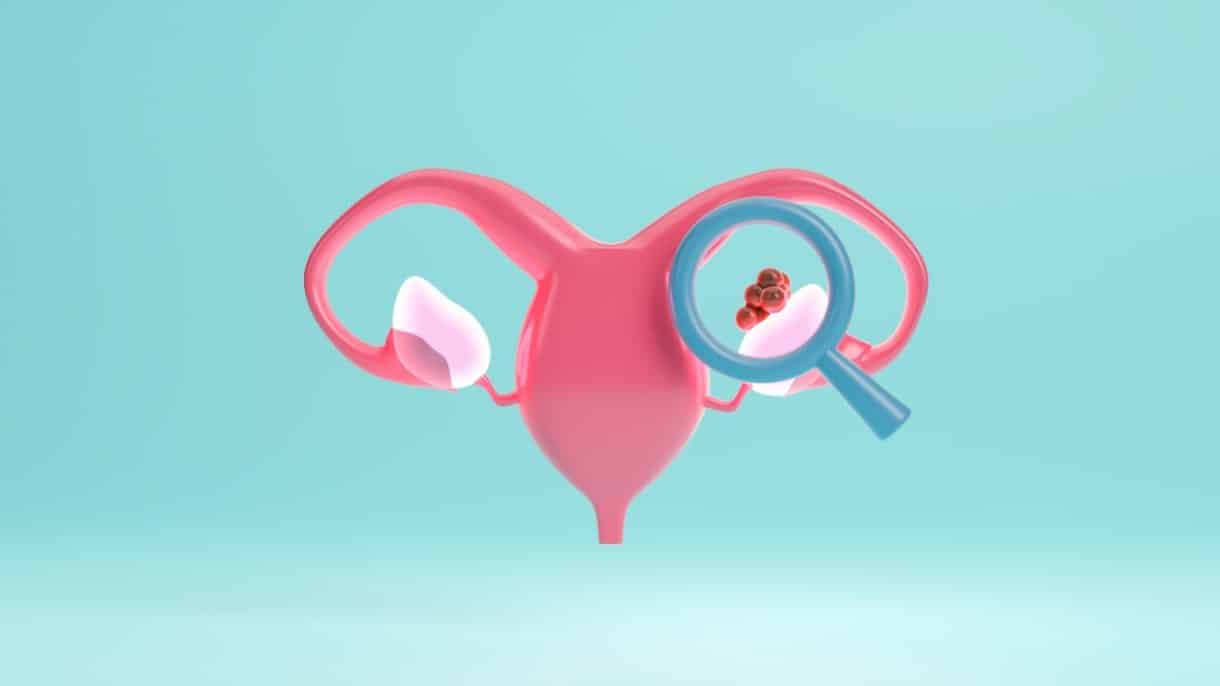 Descubren un tratamiento nuevo para el cáncer del ovario