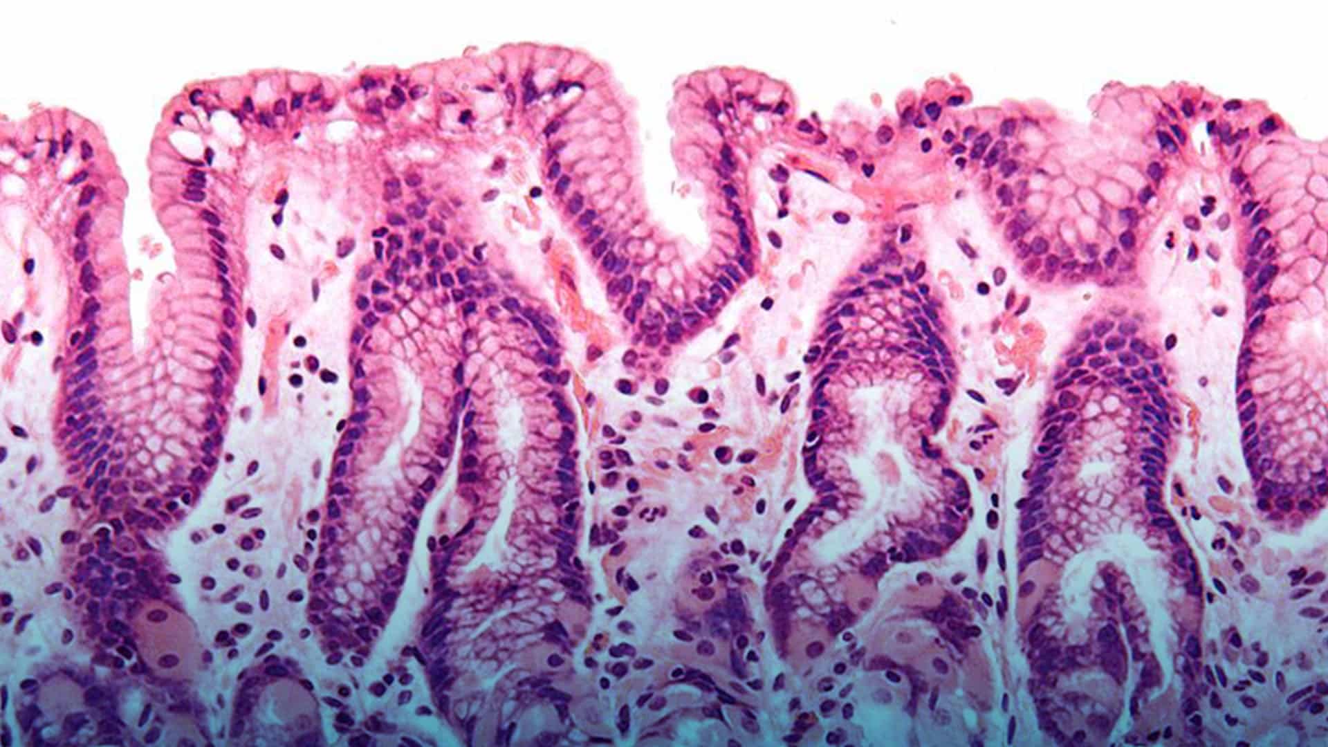 Cuidado de la microbiota intestinal
