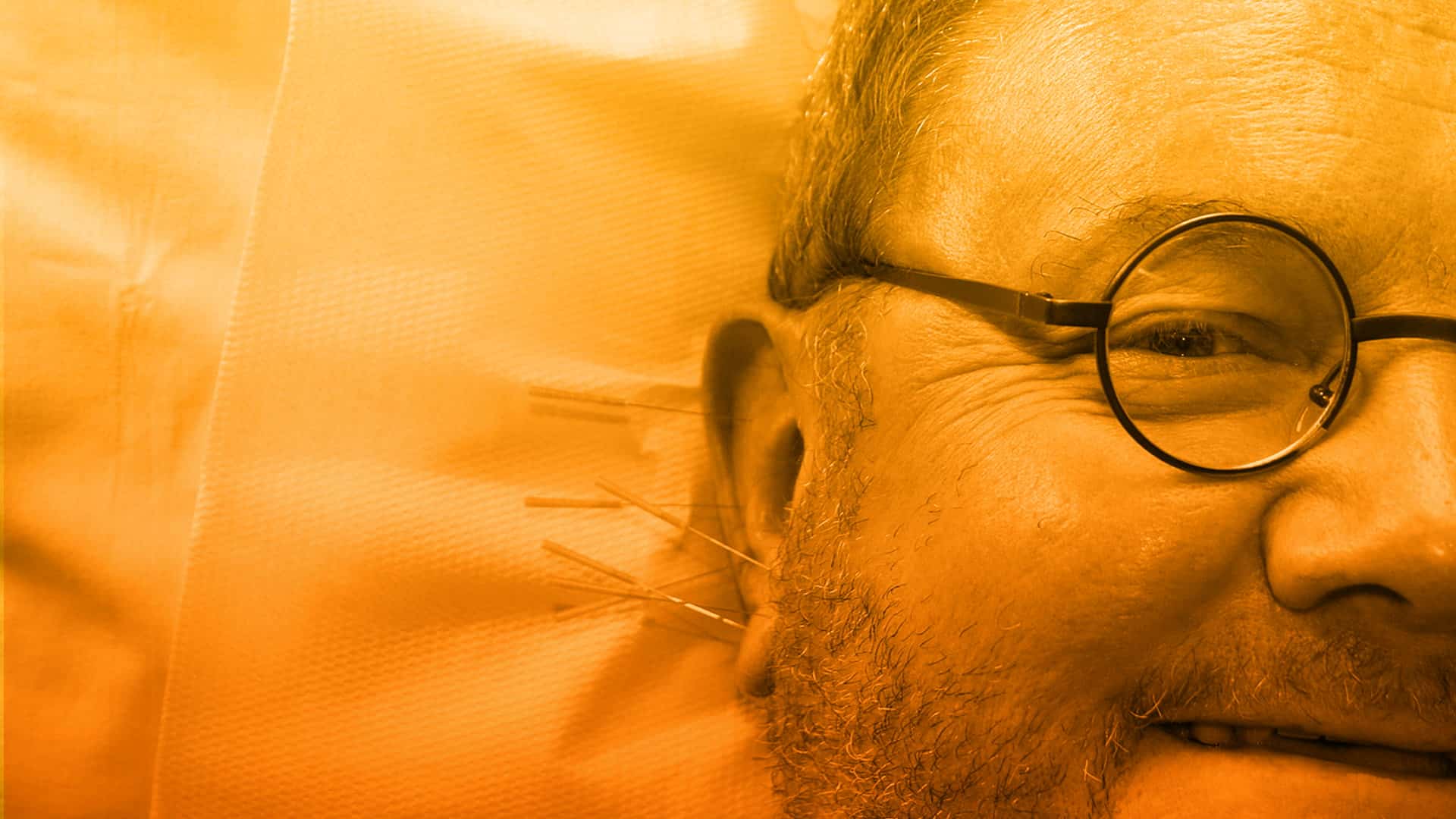 Acupuntura para aliviar cualquier tipo de dolor en el cuerpo