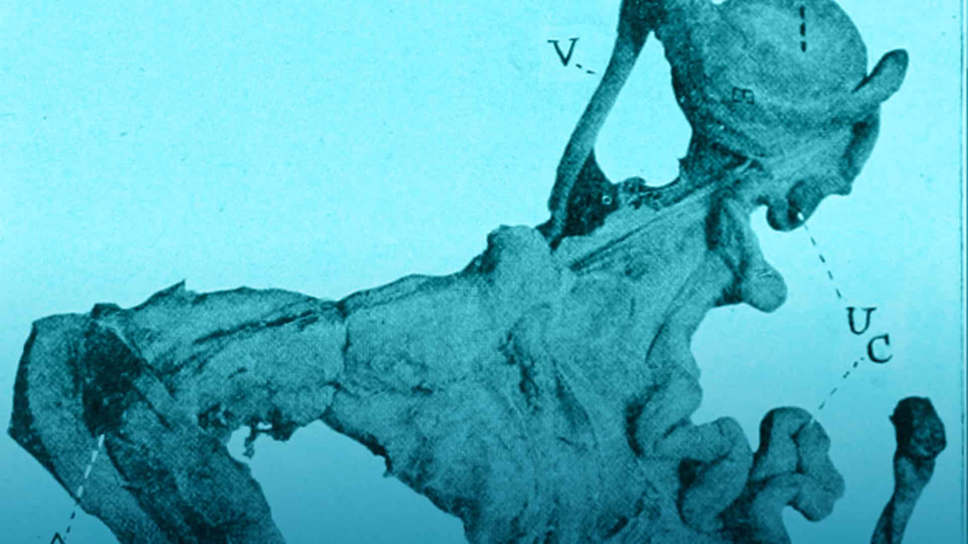 Reconstrucción aparato genital femenino