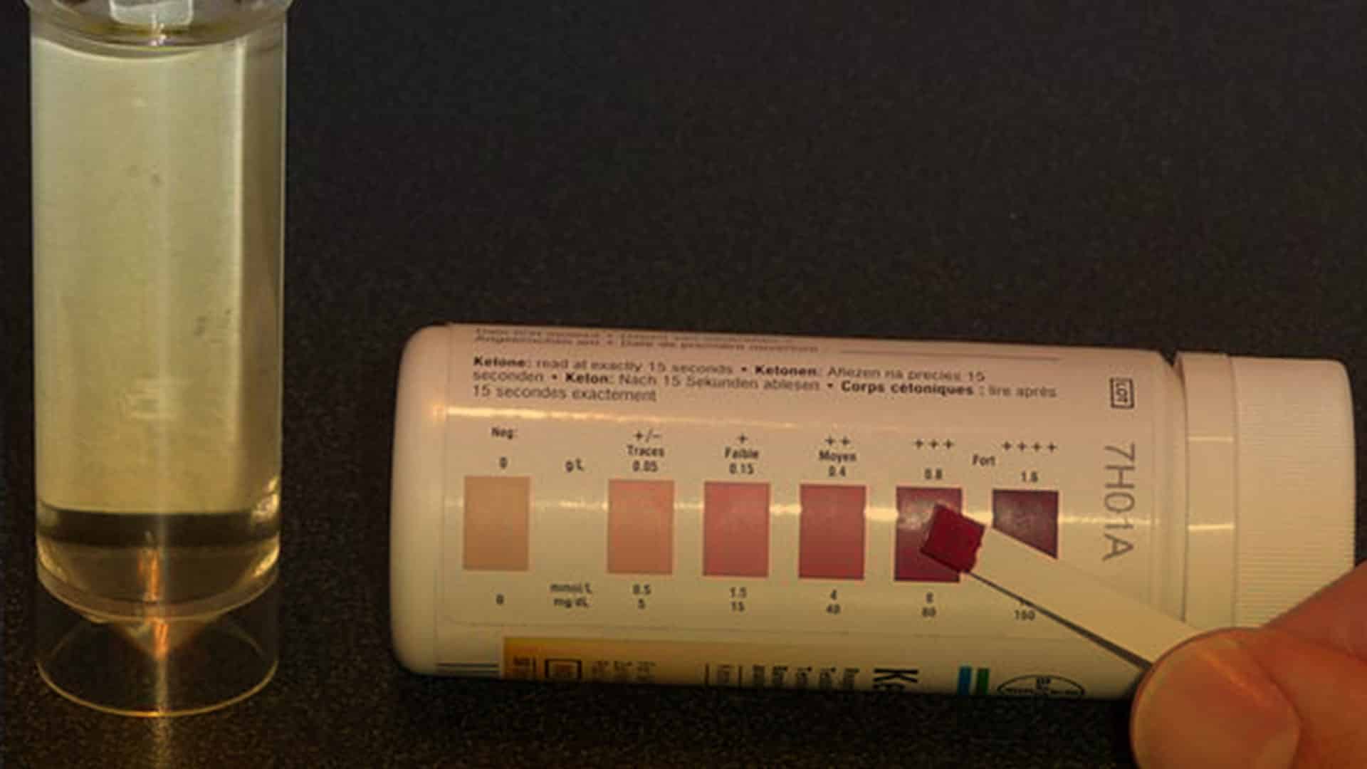 Mitos de la dieta cetogénica