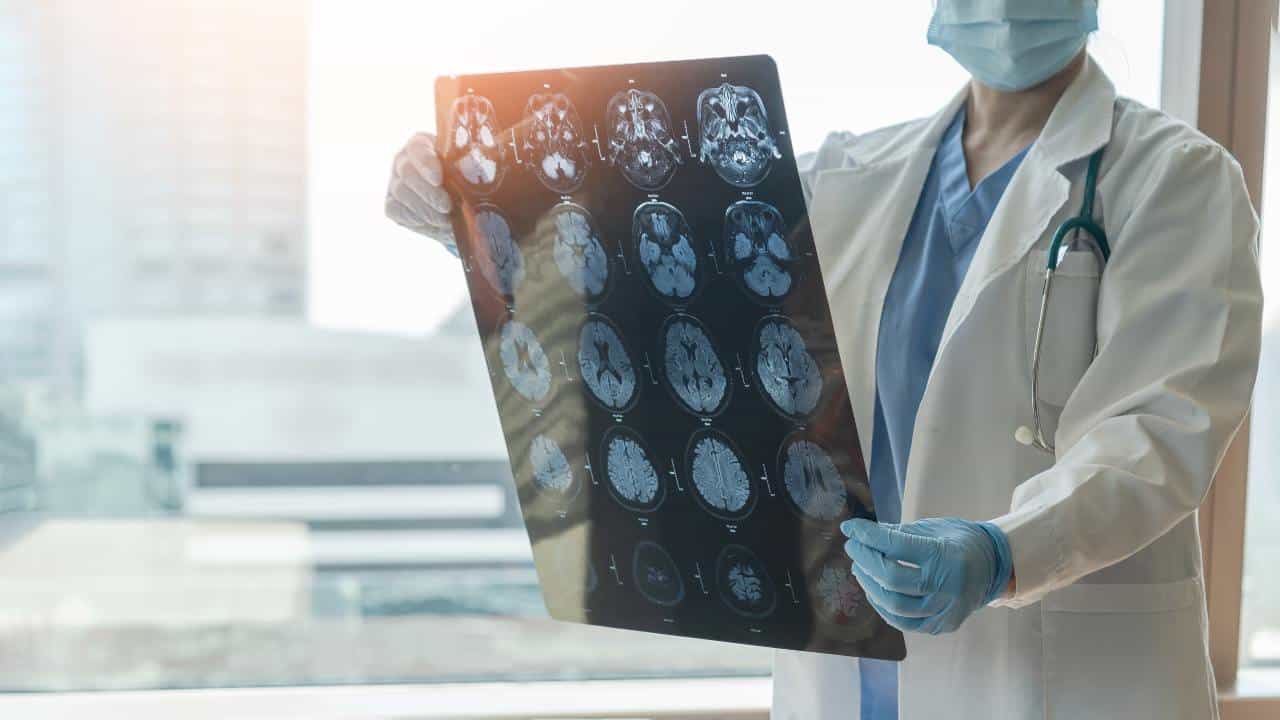 ¿Qué tienen en común la ELA y la demencia frontotemporal?