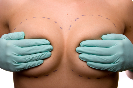 ¿Pueden los implantes del seno causar cáncer?