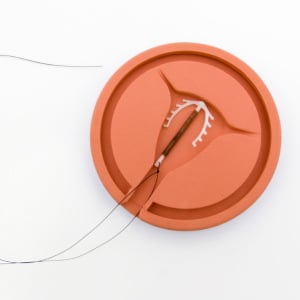 Un dispositivo intrauterino alivia los períodos menstruales con mucho sangrado