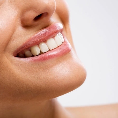¿Para qué ir al dentista?