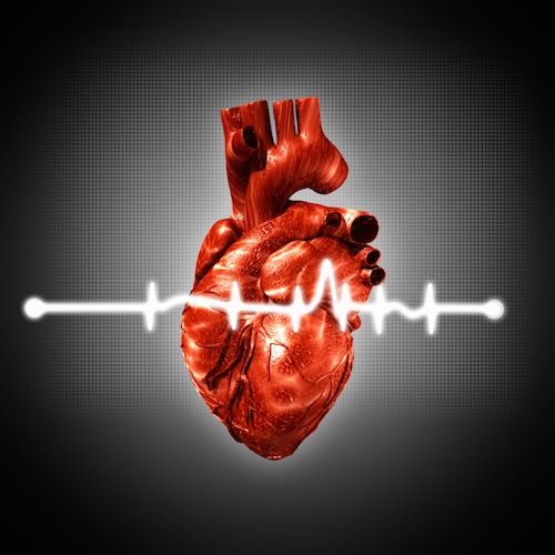 arritmias cardiacas